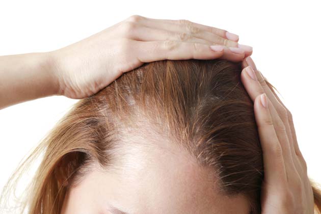 You Have Regular Anxiety About Female Pattern Baldness