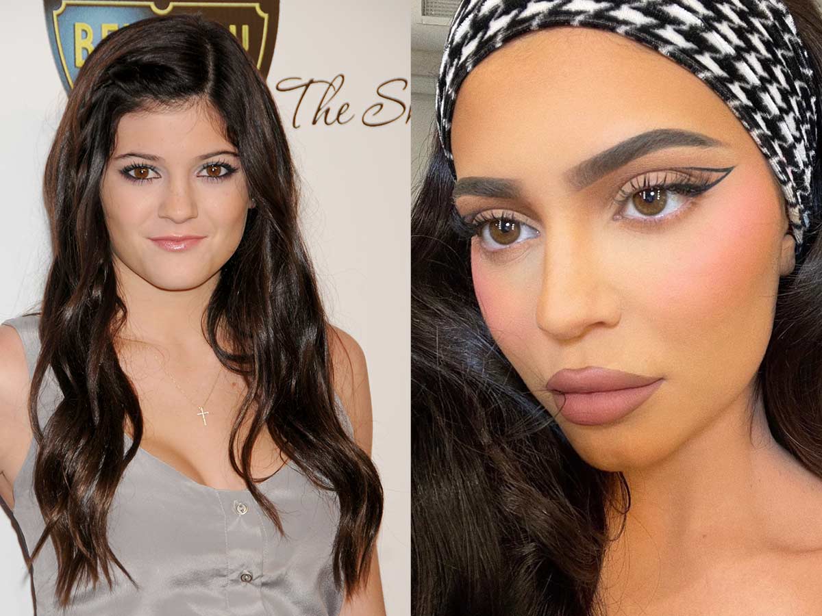 Kylie Jenner Lips