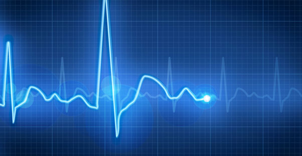 a heart rate monitor shows signs of high blood pressure in a patient