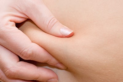 Causes of Cellulite 