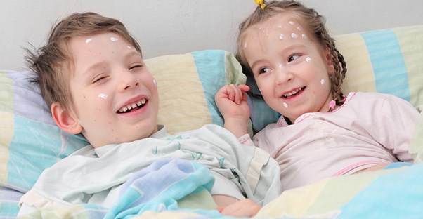 Two children with chickenpox
