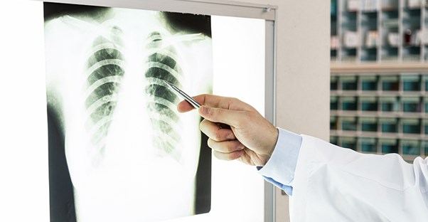 A doctor examines a chest x ray