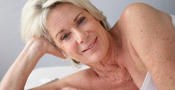 A woman with age spots
