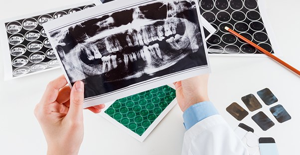 A dental x-ray