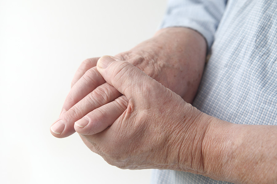 Recurrent Gout