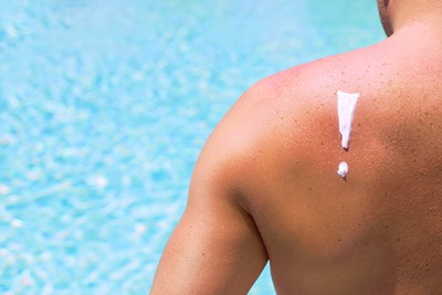How Do You Treat Sunburn Blisters? 