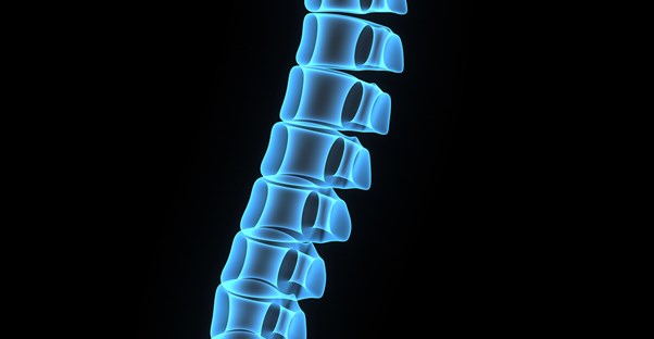 a 3D image of a spine shows places where spine pain may occur