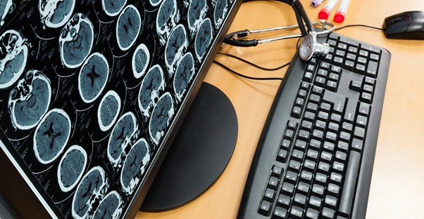brain scans fill a computer screen so a doctor can examine for the possibility of multiple sclerosis