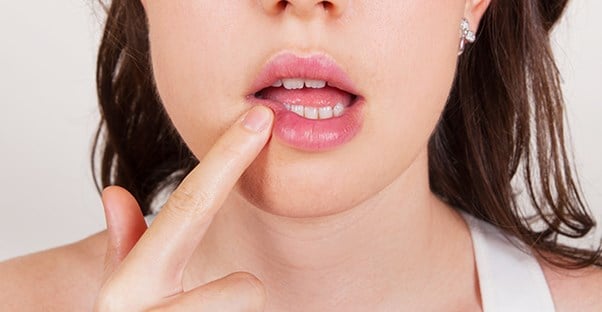 girl applying lip balm to prevent chapped lips
