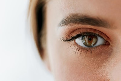 13 Ways to Relieve Itchy, Dry Eyes