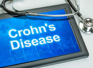 Crohn's Disease Risk Factors