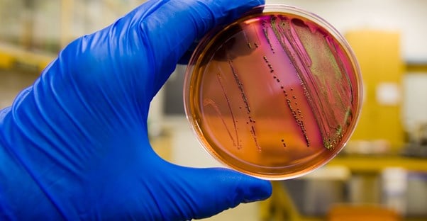 a petri dish filled with E. coli bacteria