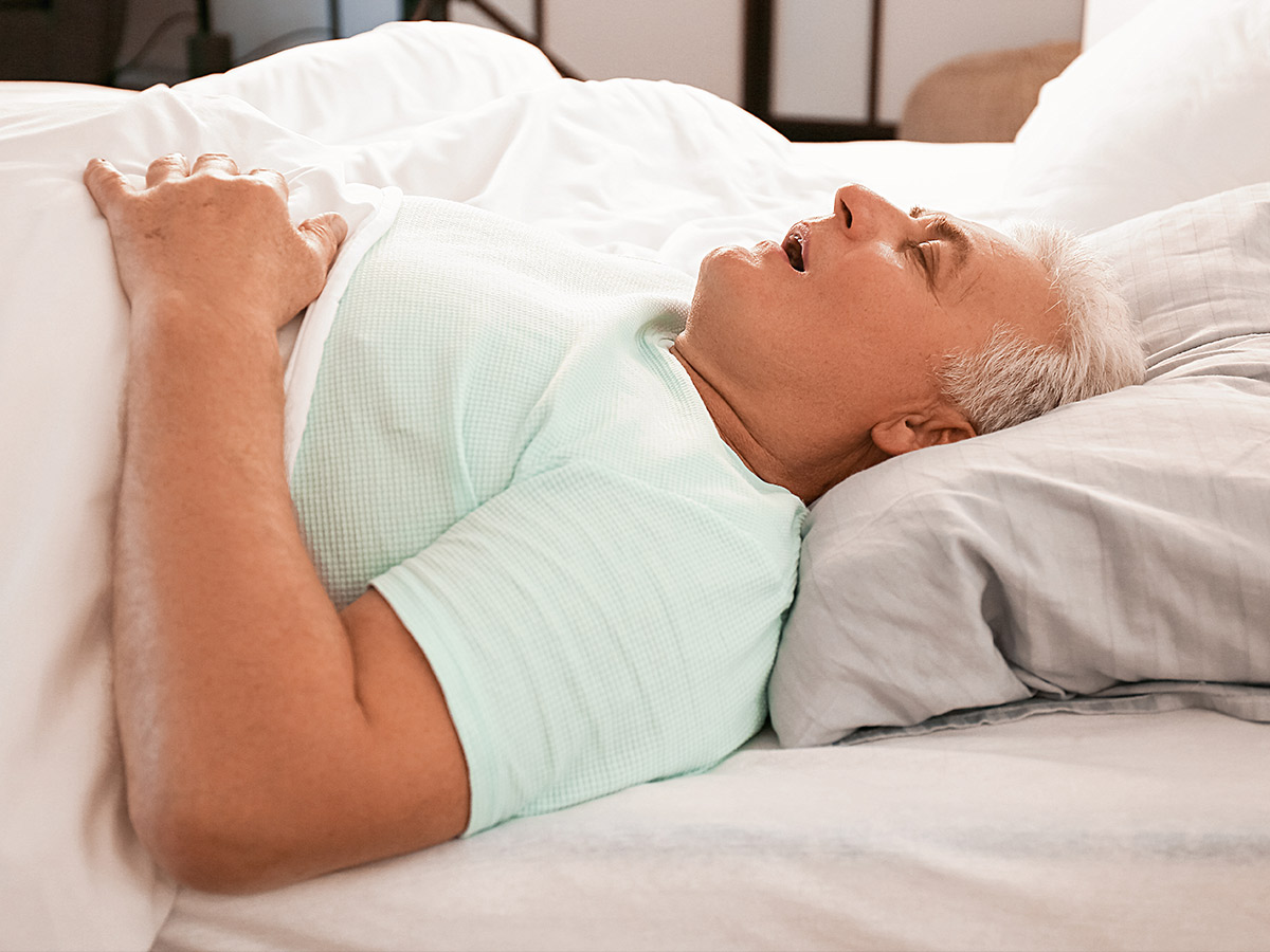 Sleep Apnea