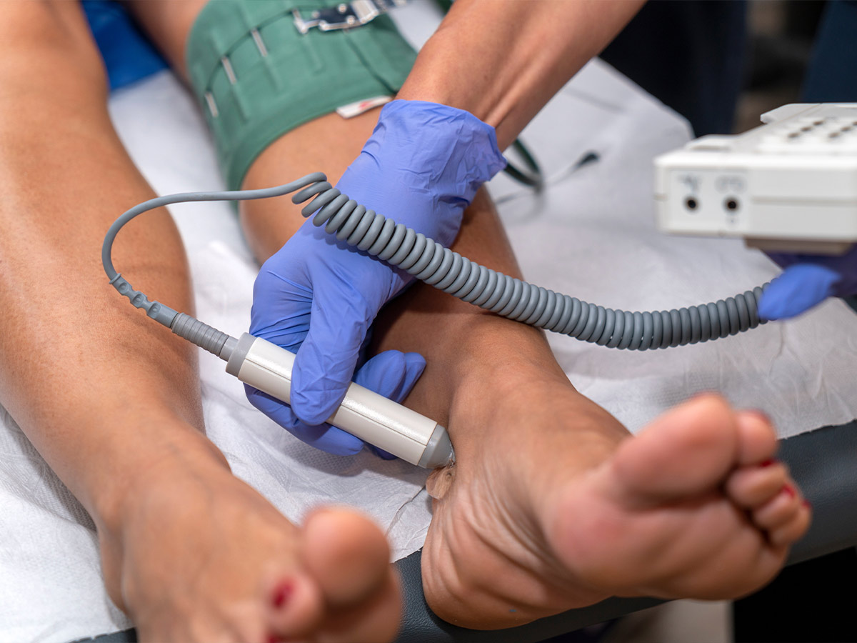 Peripheral Artery Disease