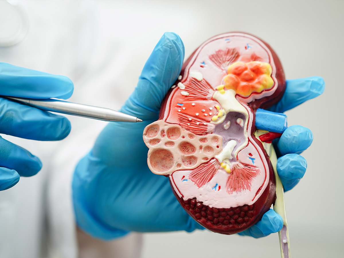 Chronic Kidney Disease