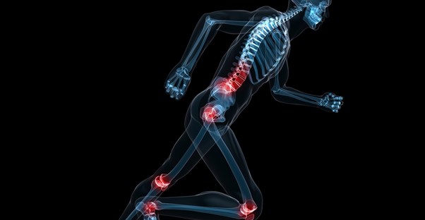 an x-ray of a skeleton shows joint pain pressure points