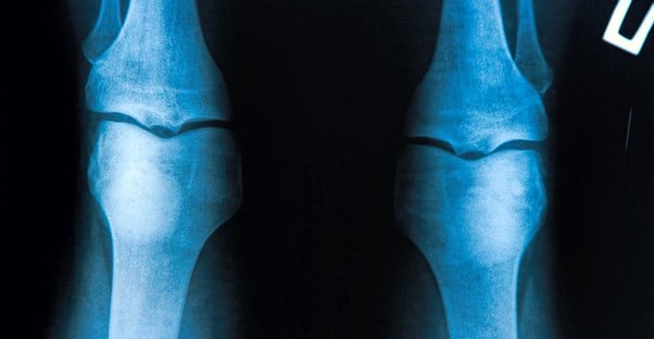 a picture of knees