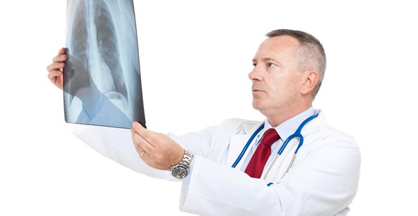a doctor examines an x-ray looking for lung cancer