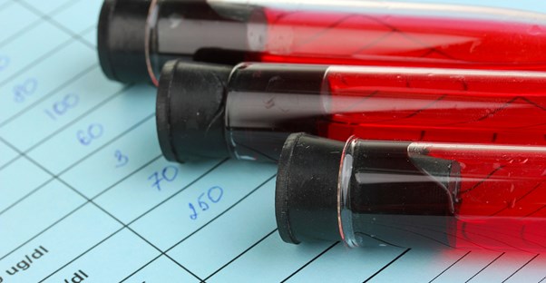 vials of blood are ready for HIV testing