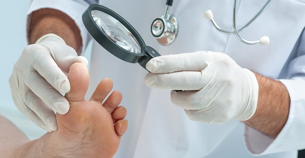 A doctor examines a patient's foot fungus