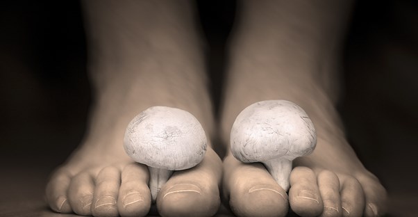 Dealing with foot fungus