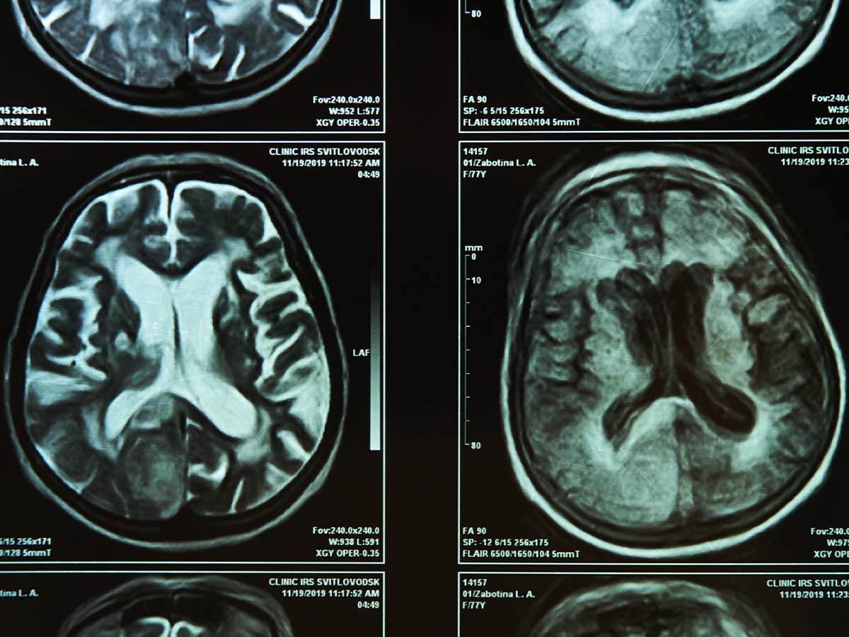 Humans Only Use 10% of Their Brains