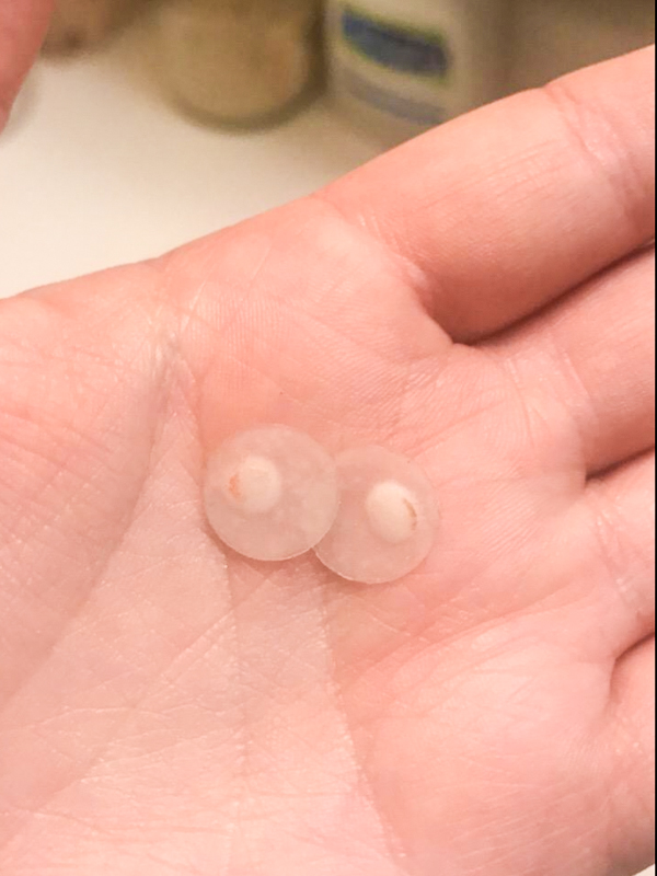 Pimple Patches
