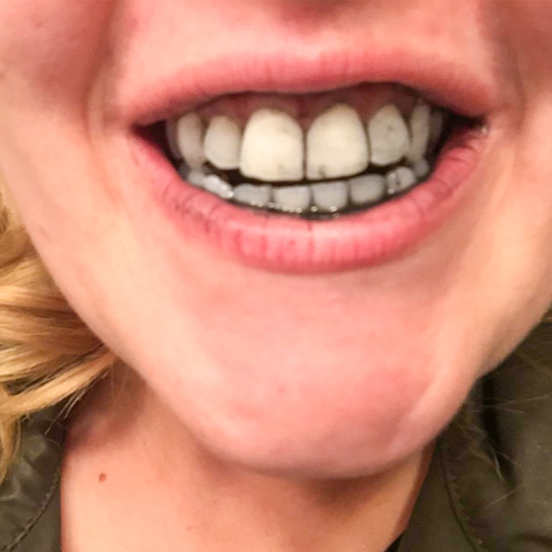 Charcoal Toothpaste