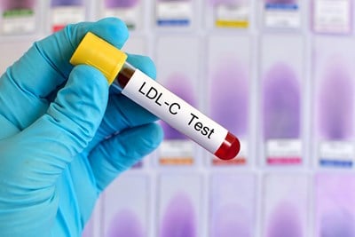 What Are Normal LDL Cholesterol Levels? 