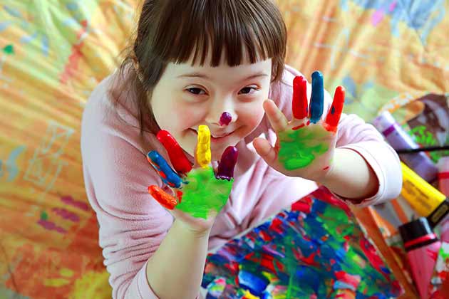 Downs Syndrome