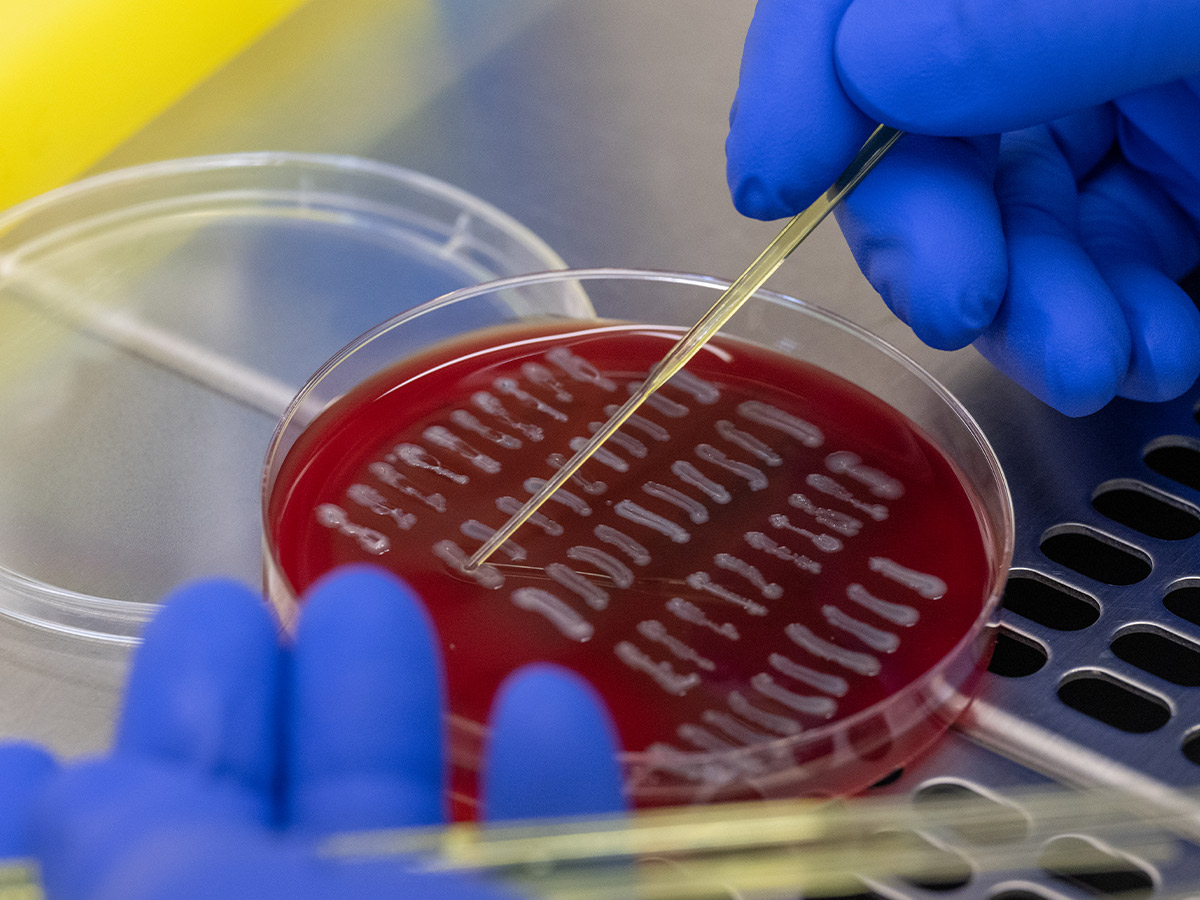 E Coli Linked to Raw Dairy