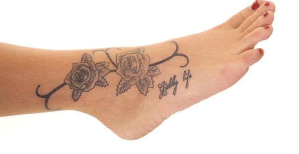 a foot tattoo that is being removed