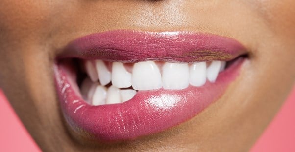 a woman who knows about the pros and cons of dental veneers