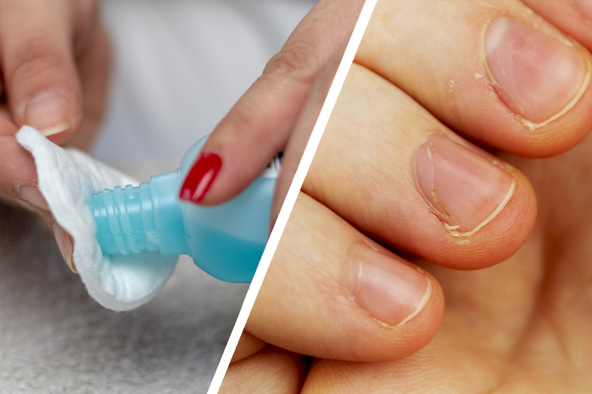 Acetone-Based Polish Remover Weakens Nails