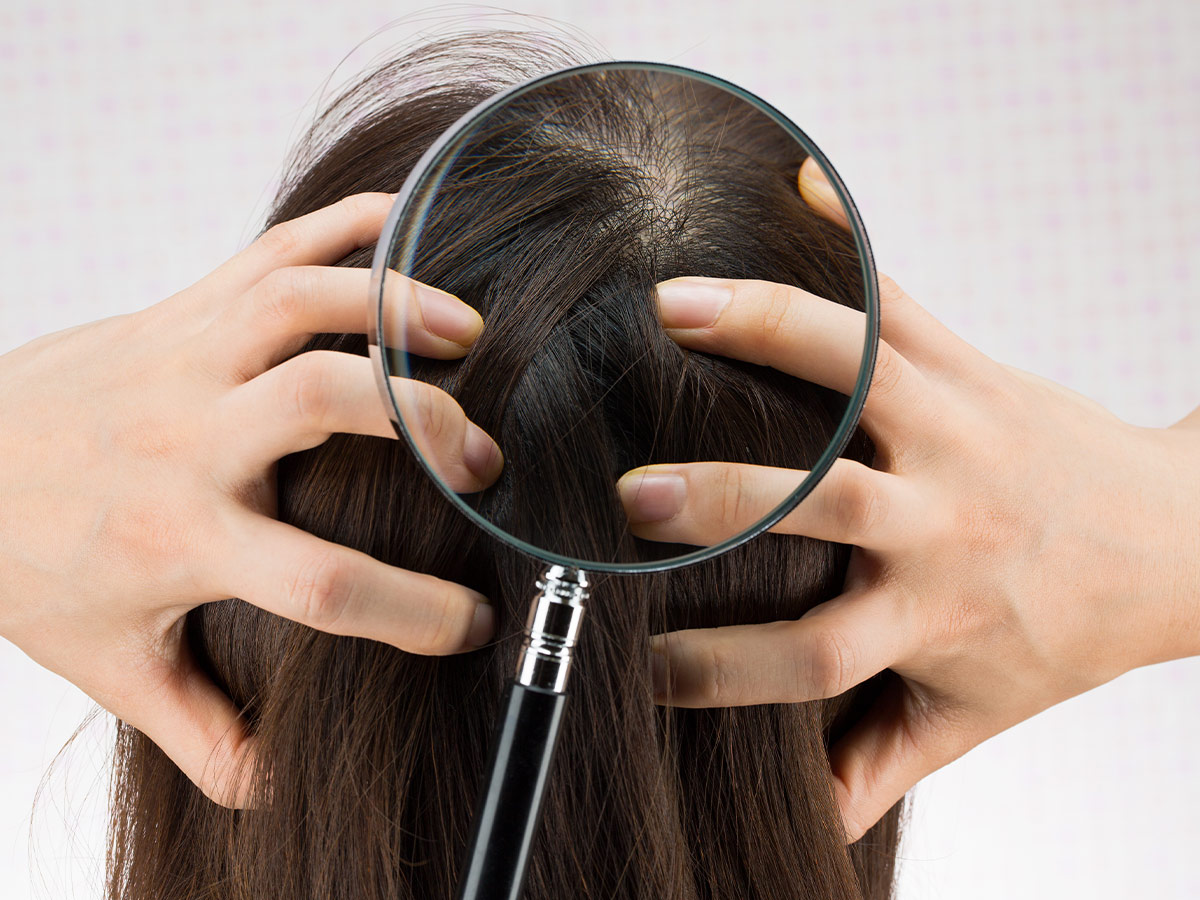 Cowlicks are a Constant Battle