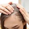 The Ultimate Guide for Making Thin Hair Look Fuller