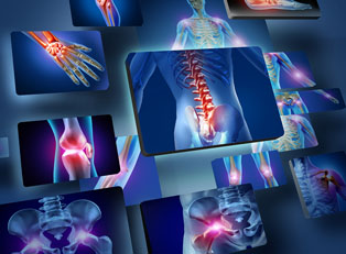 a rheumatoid arthritis x-ray shows problem points