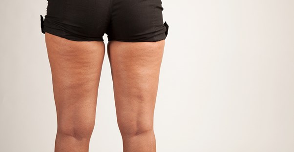 A woman embraces her cellulite