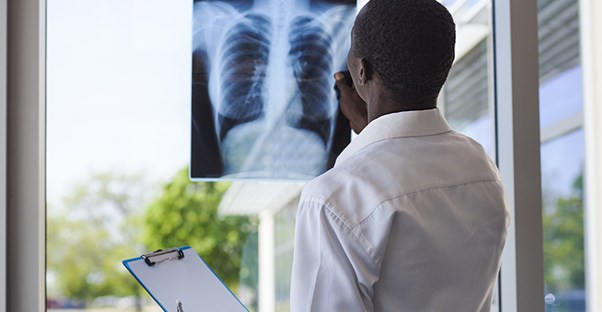 A doctor examines a lung x ray