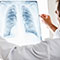 Pneumonia Causes and Risks
