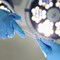 Understanding Club Foot Surgery 