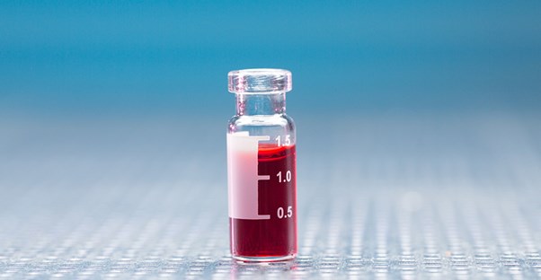 A vial of Zika infected blood