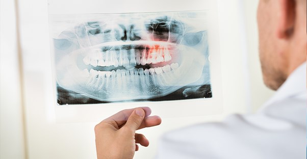 A doctor examines a dental x-ray