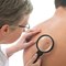 Skin Cancer Causes and Risk Factors
