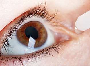 Dry Eyes Overview