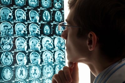 Brain Cancer Causes and Risk Factors