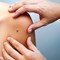 Understanding Melanoma Types