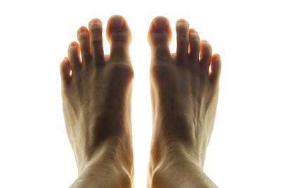 How Much Does Bunion Removal Cost? 