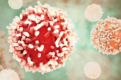 Renal Cancer Staging
