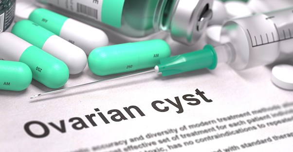 Some ovarian cyst information